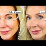 Adapalene Anti Aging before And After: Stunning Skin Transformation