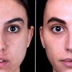 Anti Aging Facial Treatments: Top Secrets to Youthful Skin Revealed