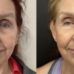 Anti Aging Physicians in My Area: Top Experts for Youthful Skin