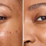 Cover Up Dark Circles under Eyes: Proven Tips for a Bright Look