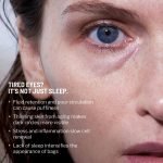 Do Bosnians Have Dark Circles under Their Eyes? Surprising Facts Revealed