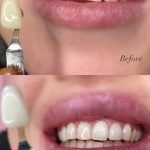 Glow N Go Beauty Bar: Ultimate Tips for Radiant Skin Today