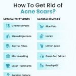 How to Remove Acne Scars Naturally Overnight: Fast & Effective Tips