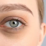 Hydroquinone for Dark Eye Circles: Effective Brightening Solution
