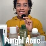 Korean Skincare for Acne Scars: Effective Tips for Clear Skin