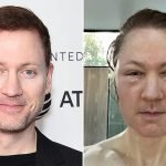 Metformin Anti Aging before And After: Stunning Transformations Revealed