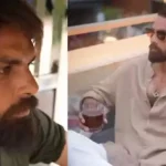 Rajesh Khanna Acne Scars: Inspiring Journey to Flawless Skin