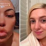 Slugging Skincare: Ultimate Guide to Glowing, Hydrated Skin