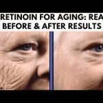 Tretinoin Anti Aging before And After: Stunning Skin Transformation Results