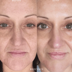 Vitamin C And Skin Rashes: Causes, Prevention & Remedies Explained