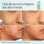 What Does Vitamin C Serum Do to Skin: Transform and Brighten Instantly