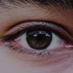 Dark Circles under Eyes Vitamin Deficiency: Causes & Solutions