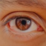 Vitamin Deficiency for Dark Circles under Eye: Causes & Solutions